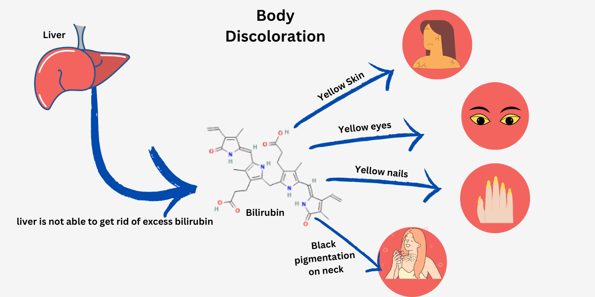 Body Discoloration