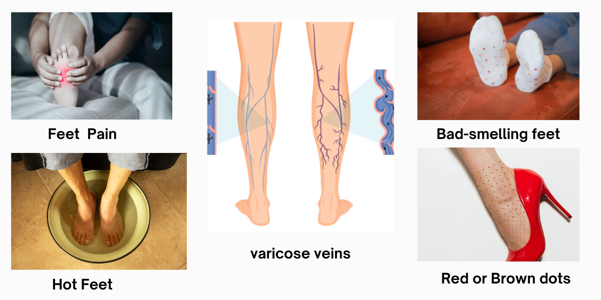 Feet liver disease symptoms